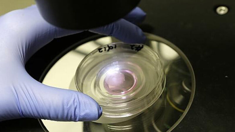 Kidney From Stem Cells: Breakthrough in Bioengineering